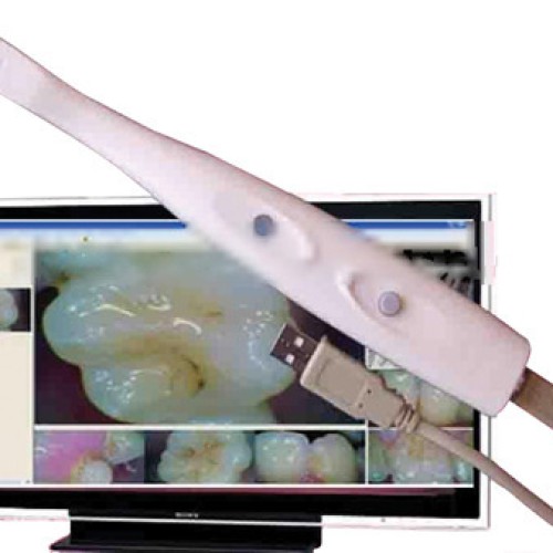 Digital oral camera