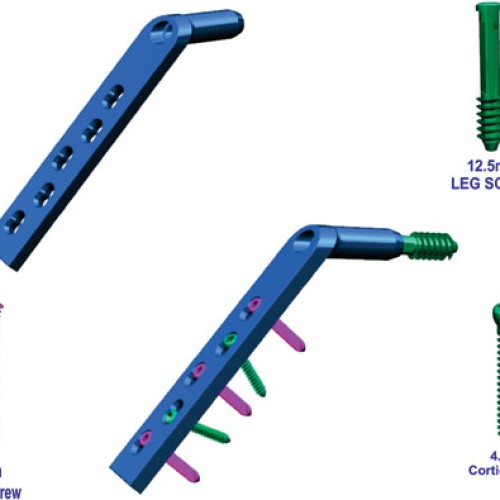 Unilocked plating system