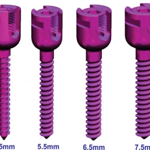 Spinal stabilization system