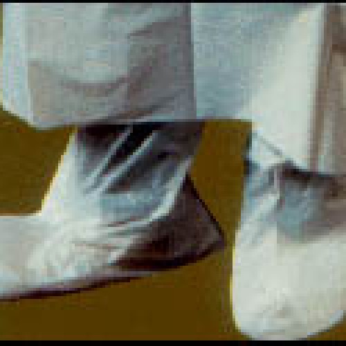 Polyethylene disposable shoe covers