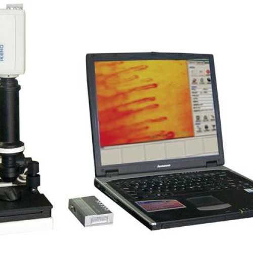 Microcirculation microscope(microcirculation analyzer)