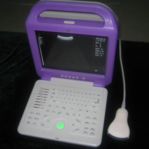 Portable ultrasound scanner