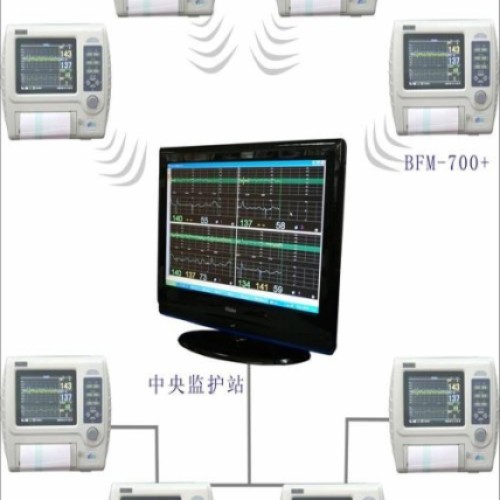 Fetal monitor