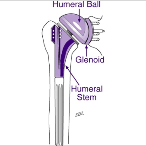 Modlar shoulders