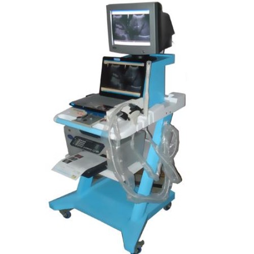 Ultrasound and Color Dopler