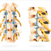 Spinal Stabilization cum Fixation System