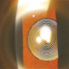 Multifocal Lens