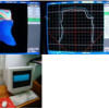Ortho Appliances