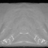imidazolidinyl urea