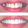 Dental Care 